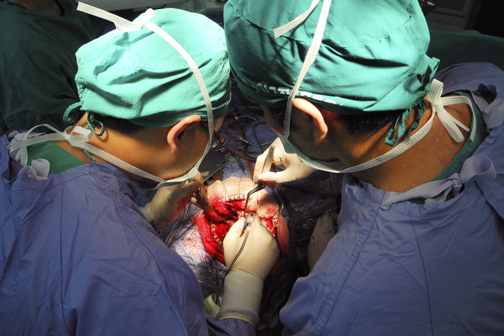 Brain Tumour Surgery in Secunderabad