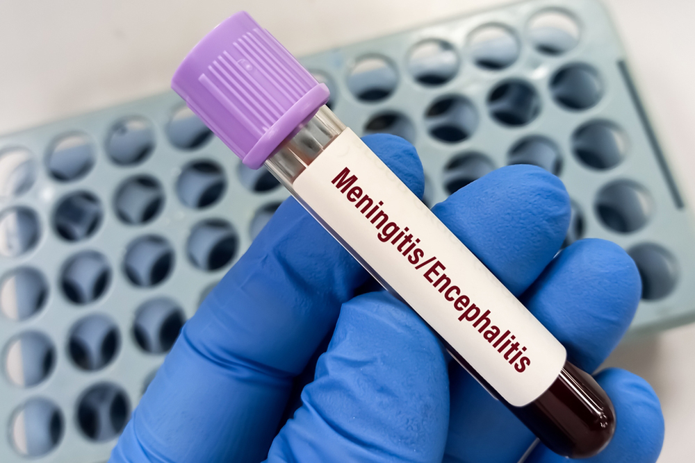 Brain Infection Treatment in Secunderabad