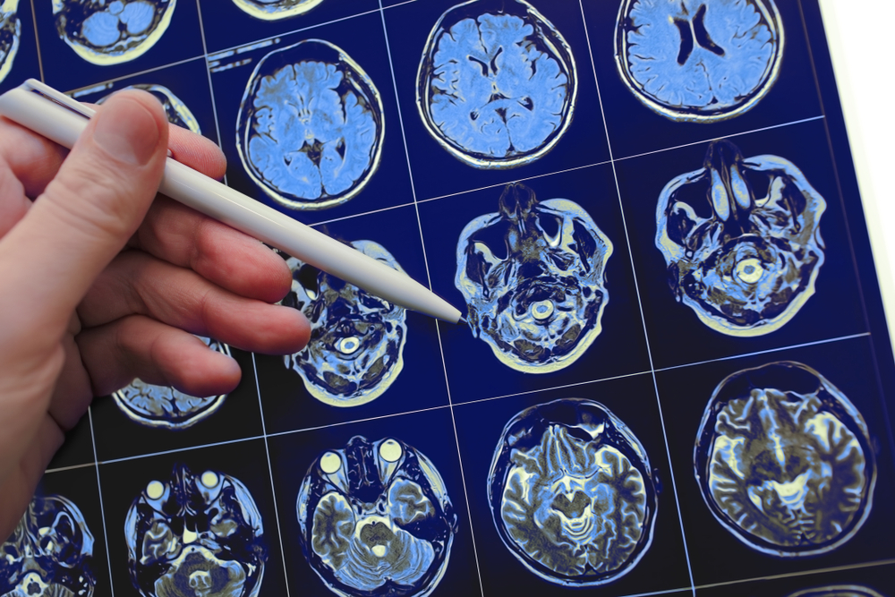 Skull Base and Vascular Neurosurgery