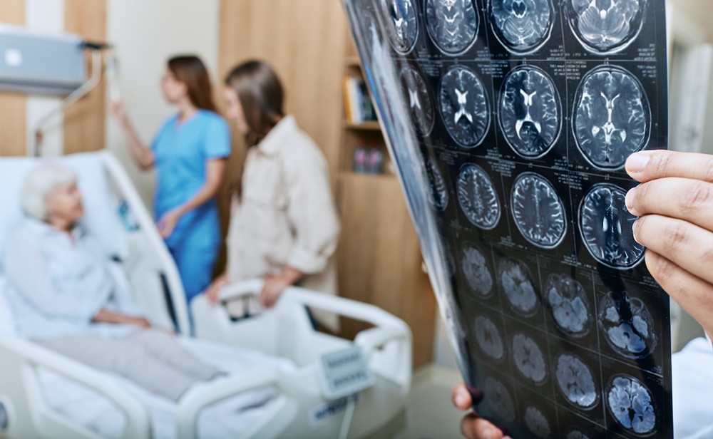 Best Neurology Hospital in Secunderabad