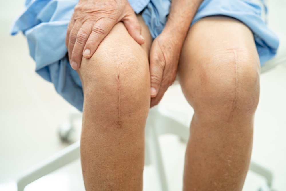 Joint Replacement Hospital in Secunderabad