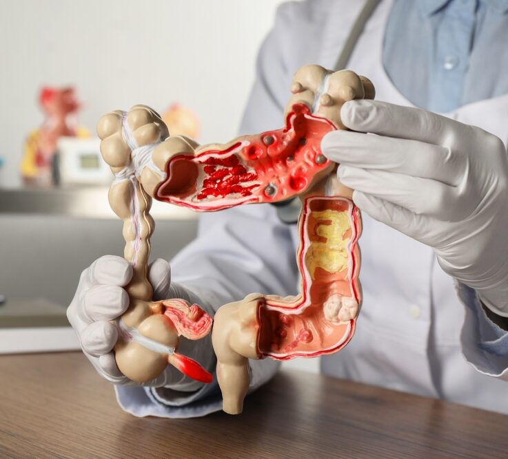 Gastroenterology Hospital in Secunderabad