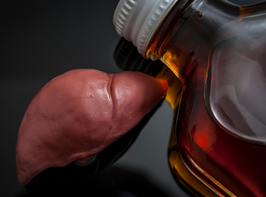 Liver Cirrhosis hospital in Secunderabad
