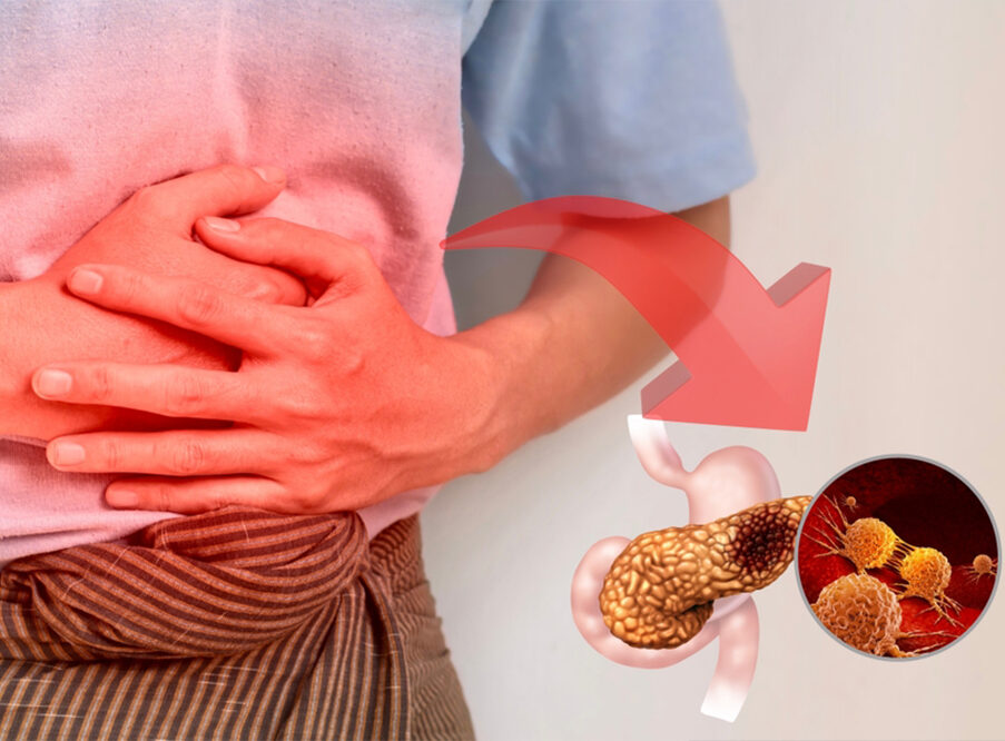 Pancreatitis Treatment In Secunderabad