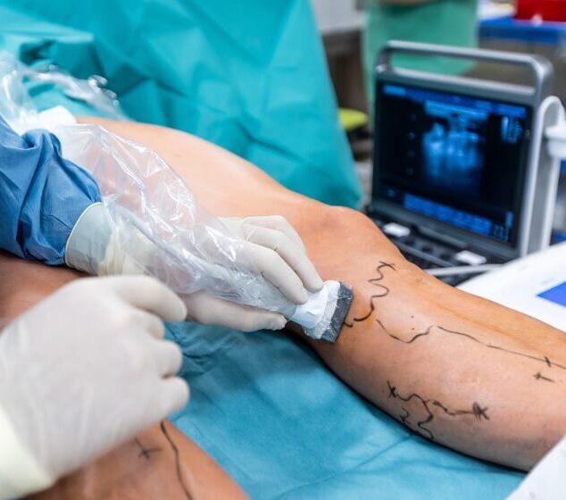 Best Vascular Surgeon in Secunderabad