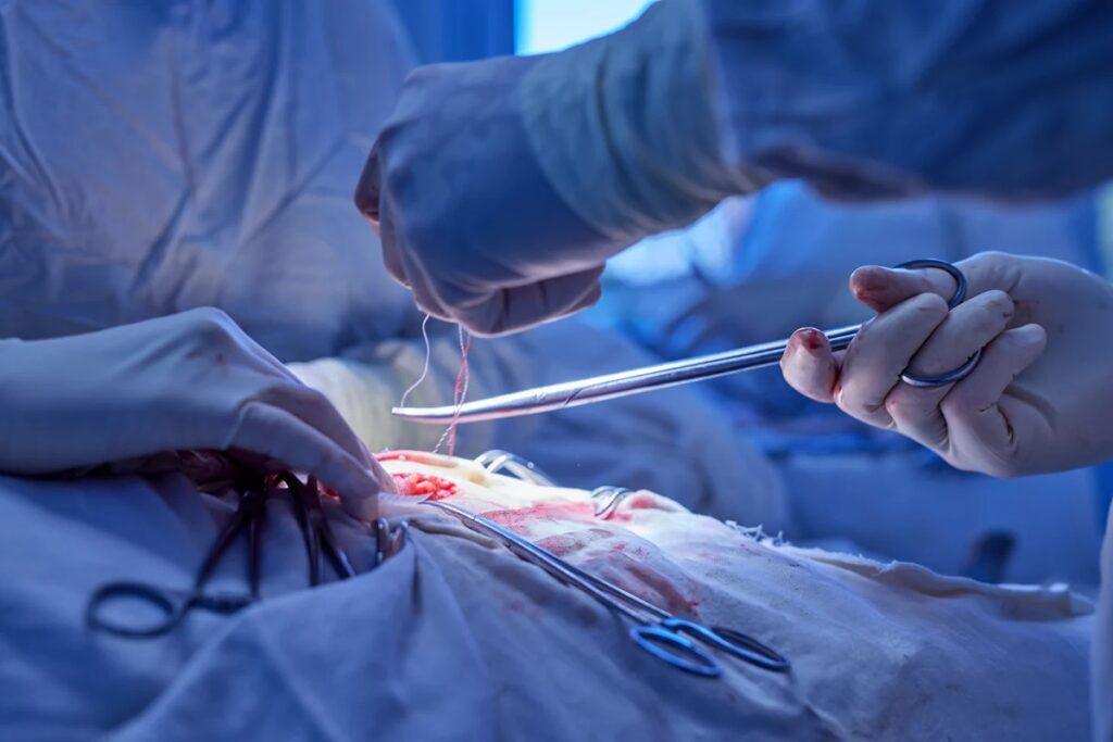 Vascular Surgery in Secunderabad