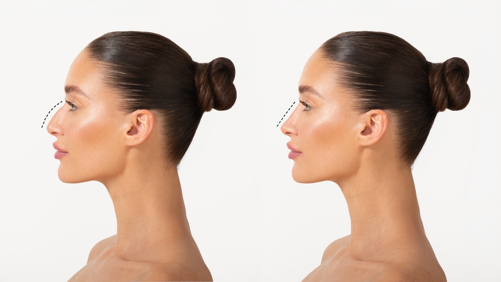Best Plastic and Reconstructive Surgery Hospital in Secunderabad