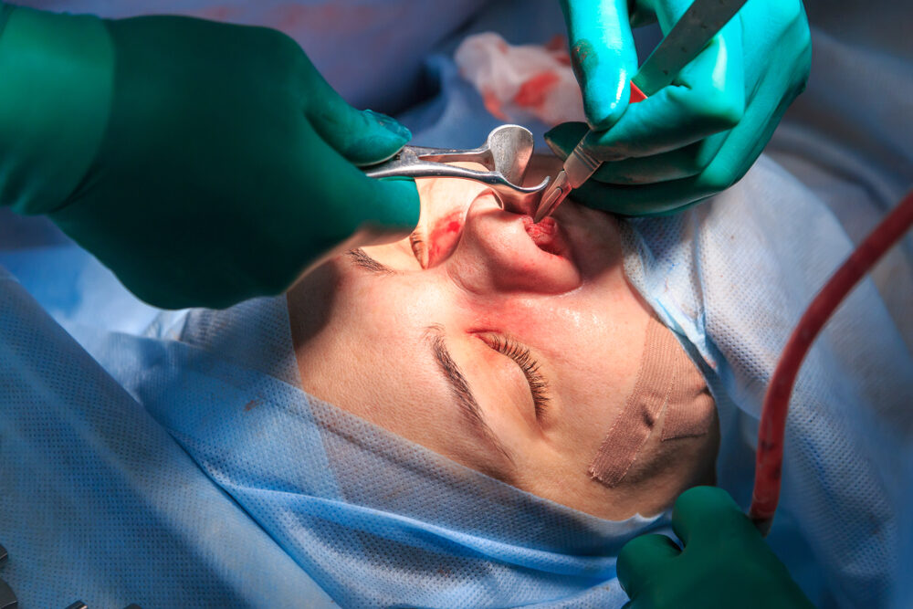 Best Plastic & Reconstructive Surgery Hospital in Secunderabad