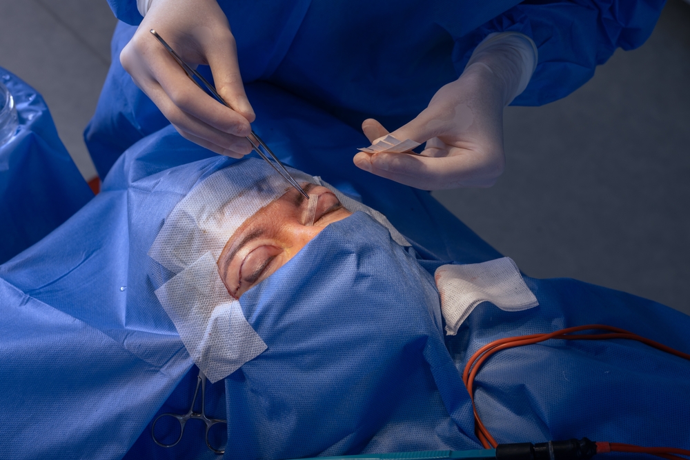 Eyelid Surgery in Secunderabad