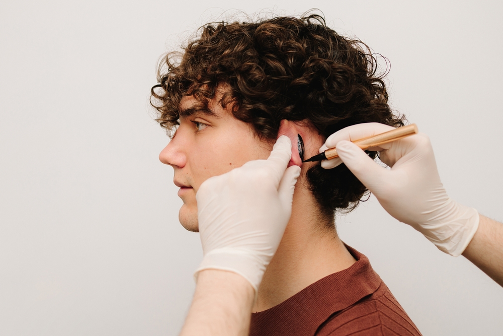 Best Otoplasty Surgeon in Secunderabad
