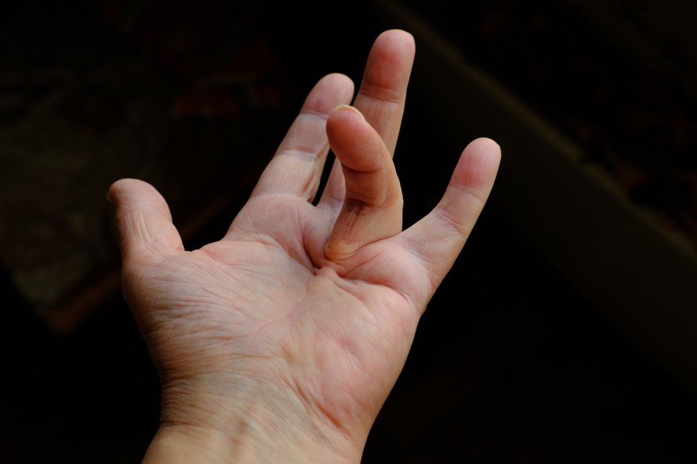 Hand Surgery Specialist in Secunderabad