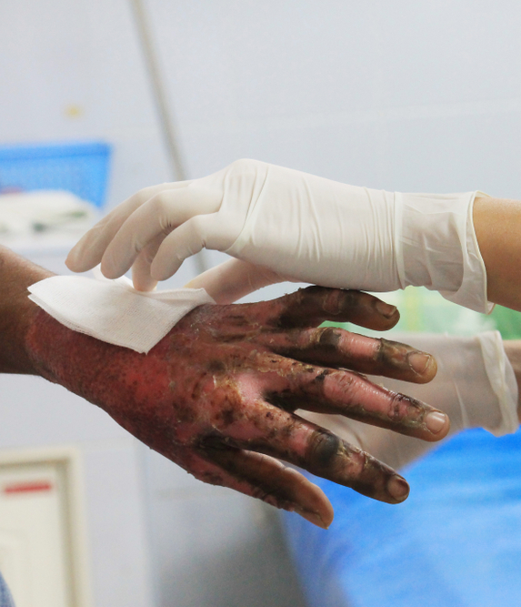 Burn & Trauma Reconstruction