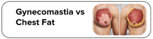 gynecomastia vs chest fat