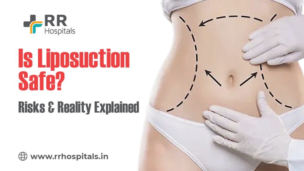 is liposuction safe