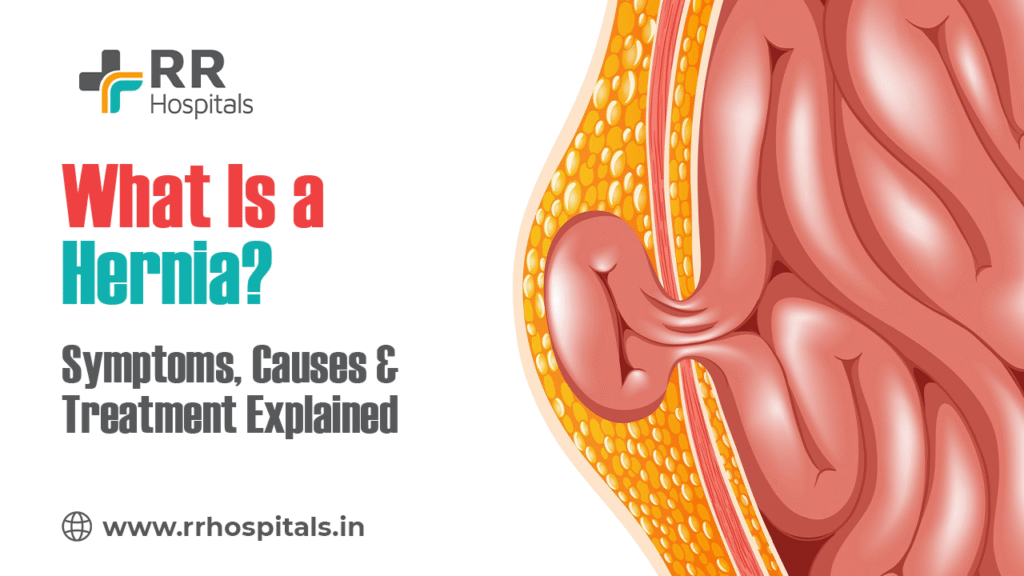 Hernia treatment