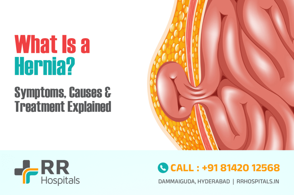 What Is a Hernia? Symptoms, Causes & Treatment Explained