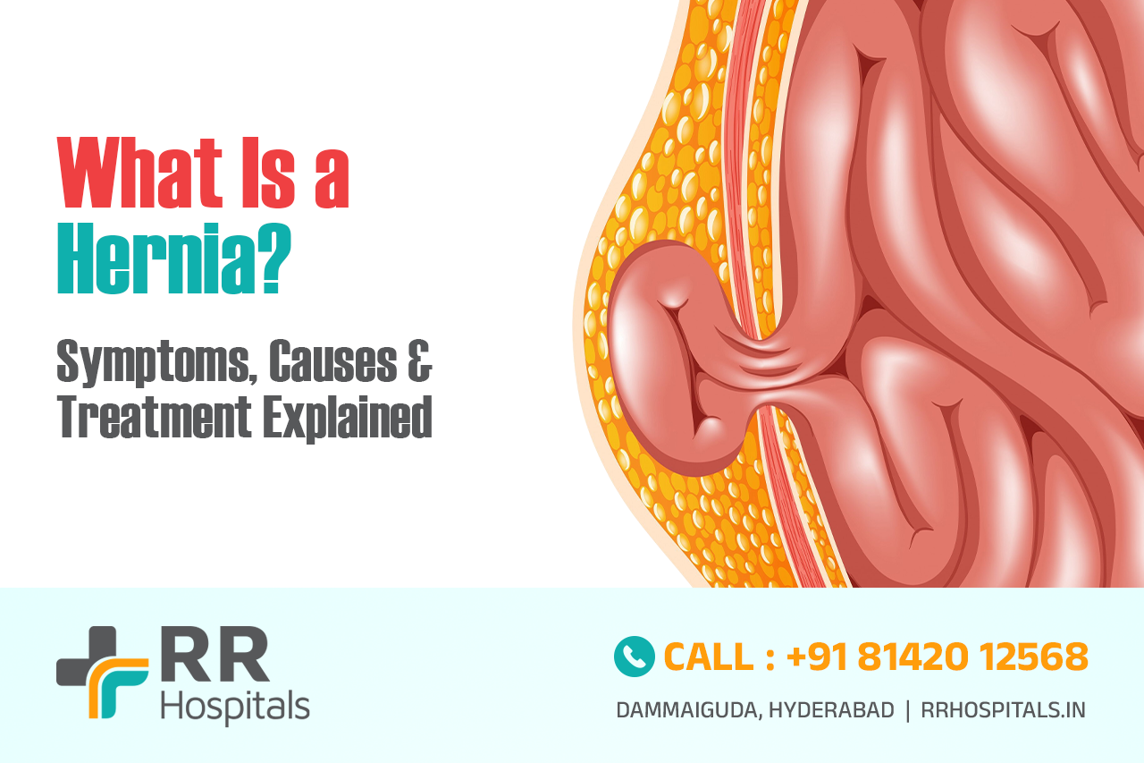 Hernia treatment