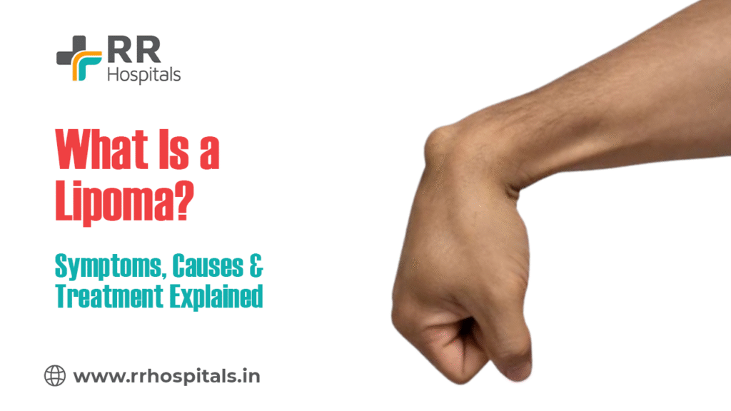 What Is a Lipoma