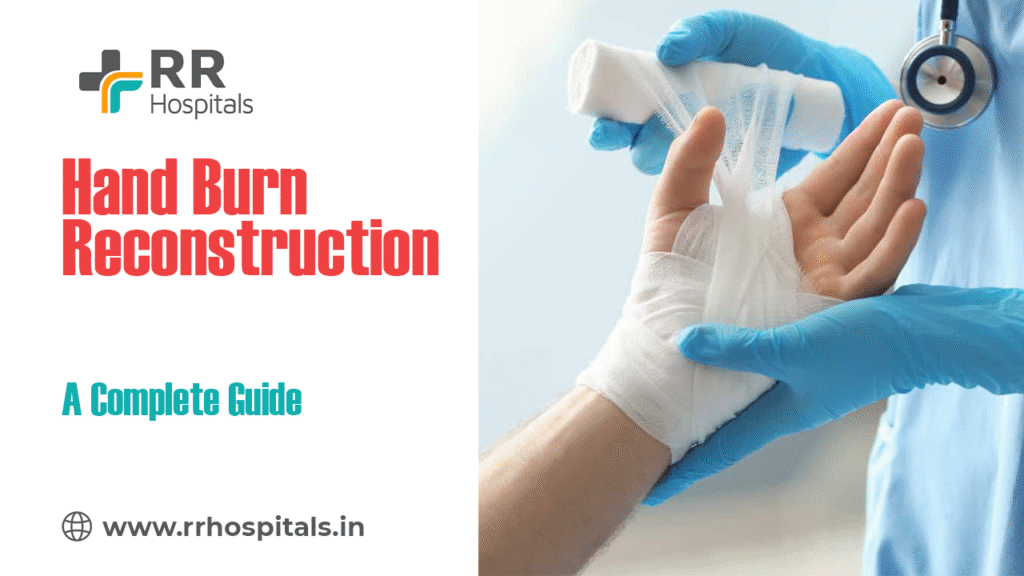 hand burn reconstruction