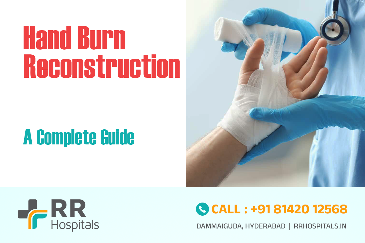 hand burn reconstruction