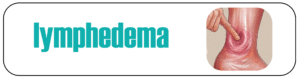 lymphedema
