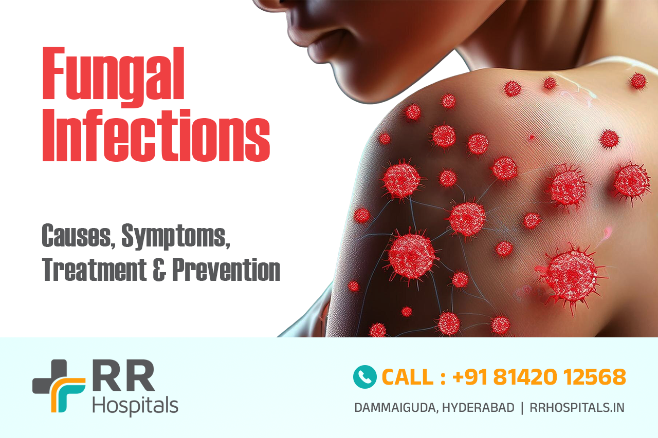 Fungal infection