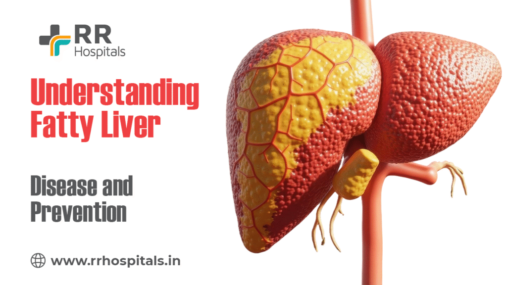 fatty liver disease