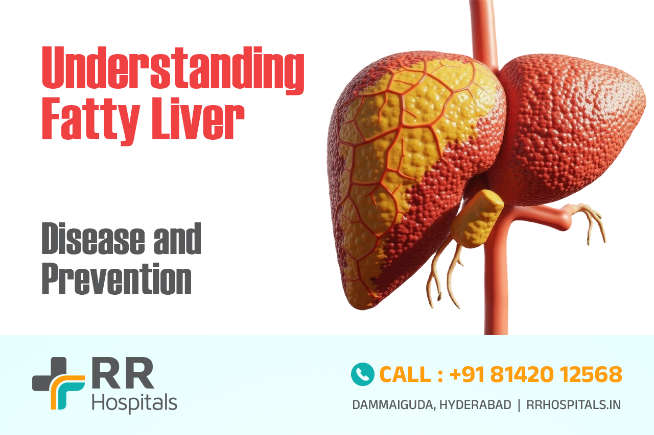 fatty liver disease