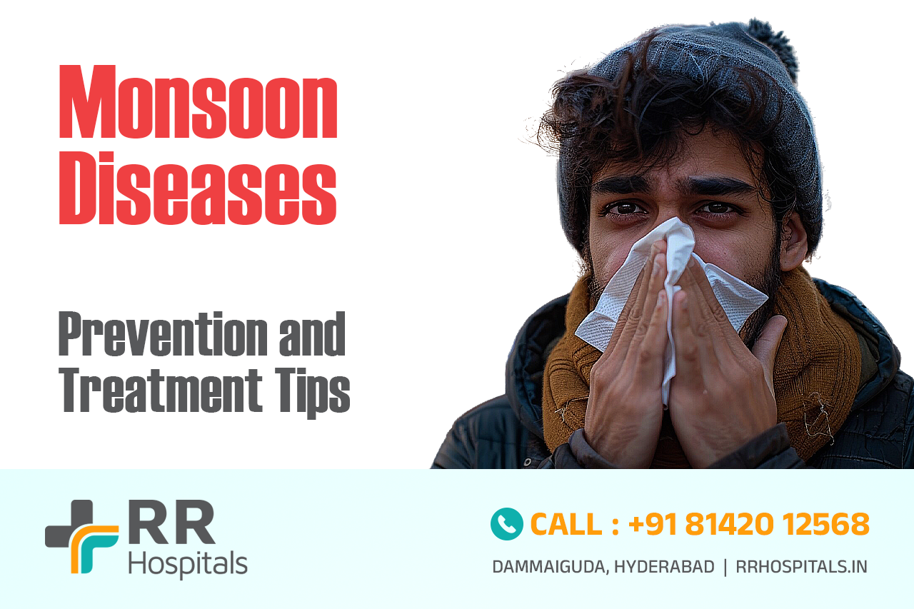 Monsoon Diseases