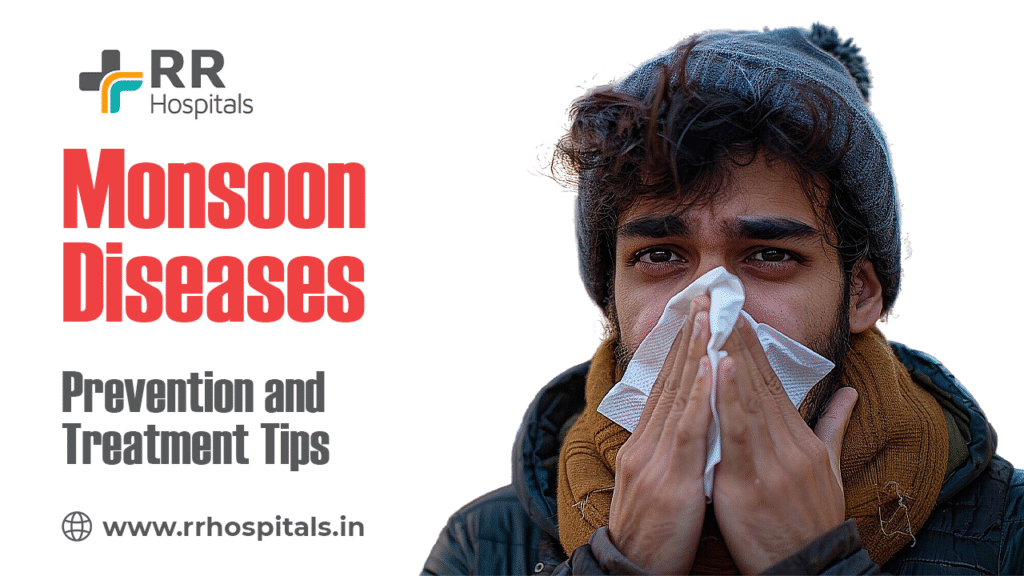 Monsoon Diseases