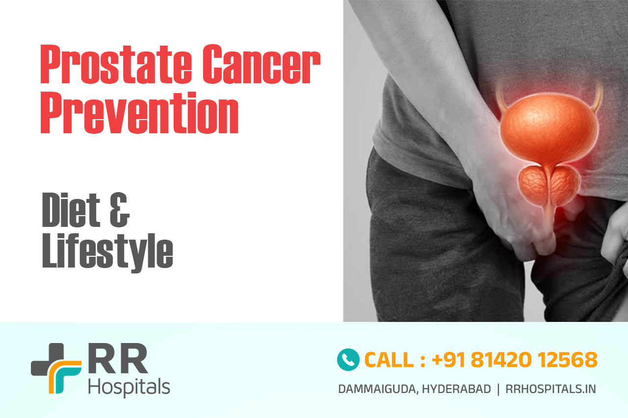 prostate cancer prevention