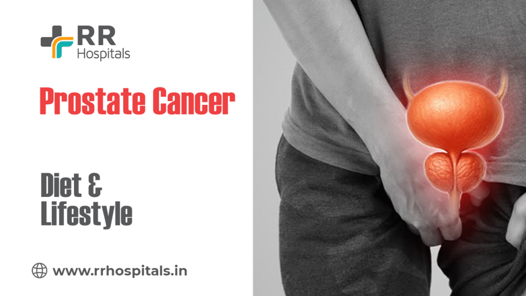 prostate cancer prevention
