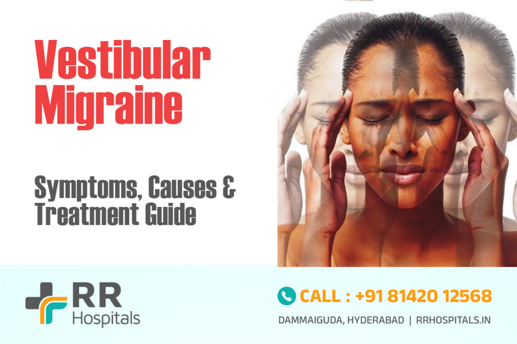 vestibular migraine
