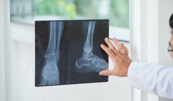 Unrecognizable medical practitioner examining X-ray picture of legs near window in doctor's office